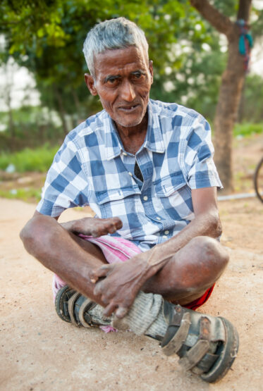 Seva Jyoti Leprosy Rehabilitation Centre near Nellore, India