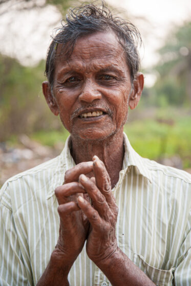 Seva Jyoti Leprosy Rehabilitation Centre near Nellore, India